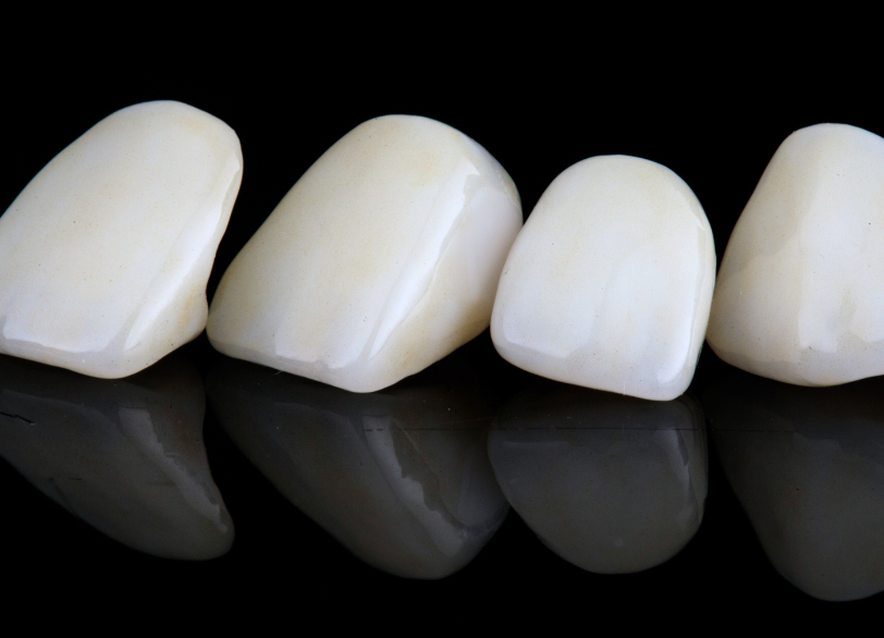 セラミックの特性|板橋グレース歯科医院