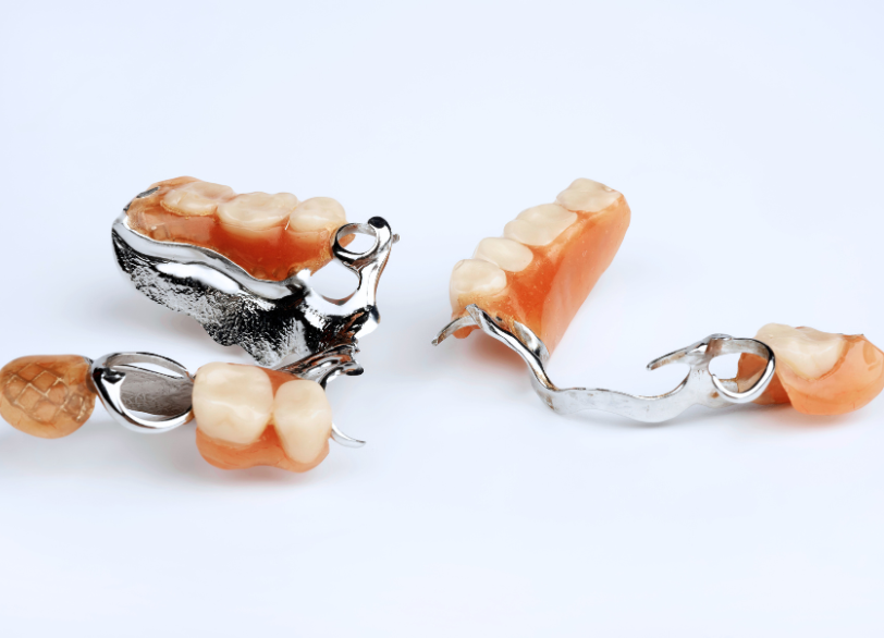 金属床義歯｜板橋グレース歯科医院