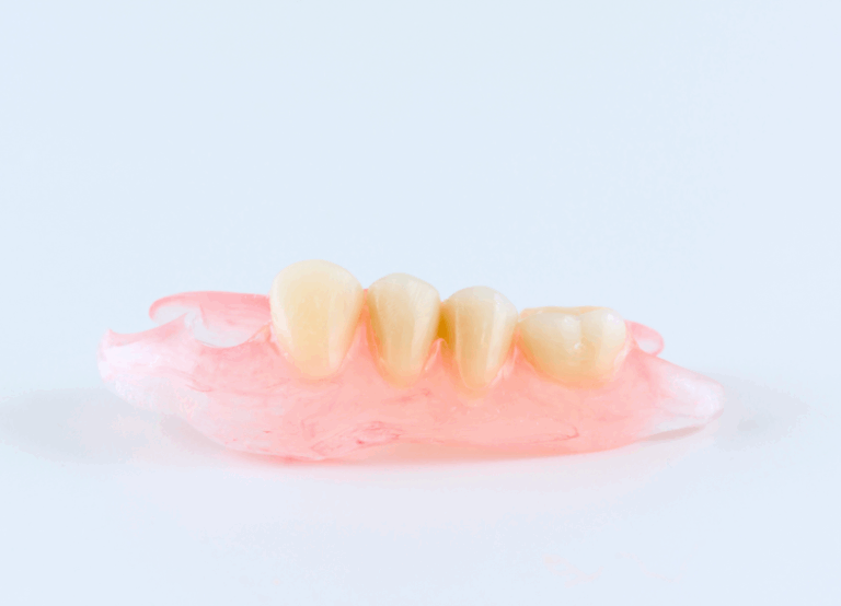 ノンクラスプデンチャー｜板橋グレース歯科医院