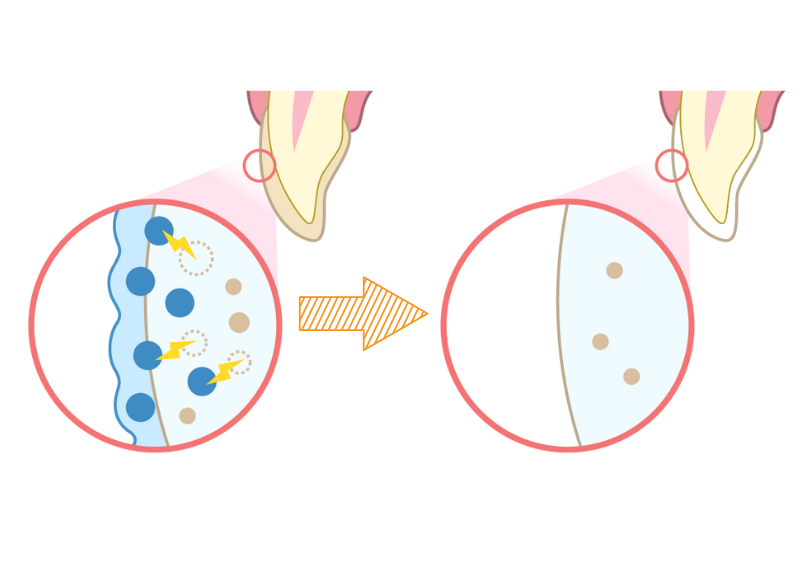 歯が白くなる、ホワイトニングの仕組み｜板橋グレース歯科医院