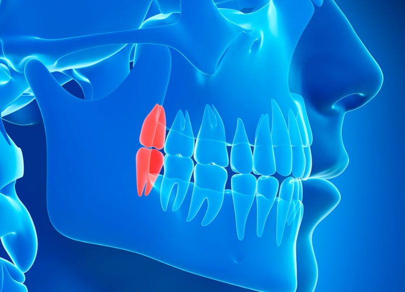 親知らずとは｜板橋グレース歯科医院