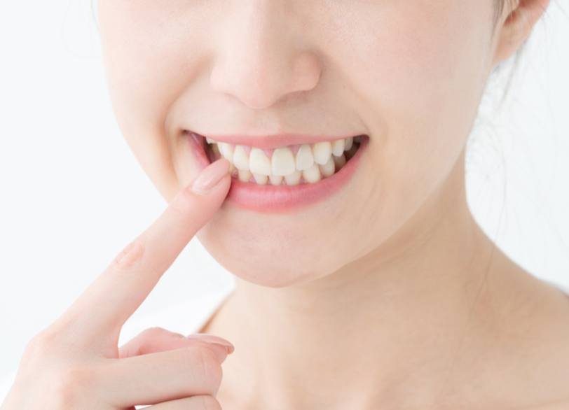矯正歯科治療で手に入れる一生涯の財産｜板橋グレース歯科医院