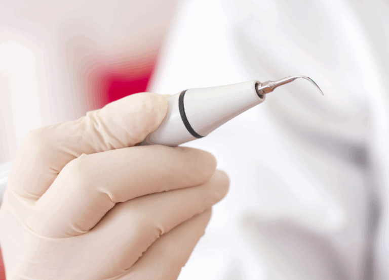 超音波スケーラー｜板橋グレース歯科医院