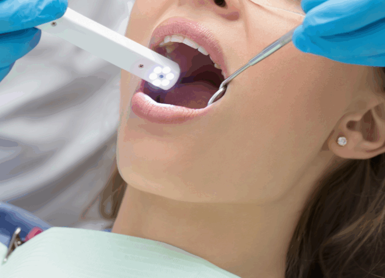 口腔内写真｜板橋グレース歯科医院