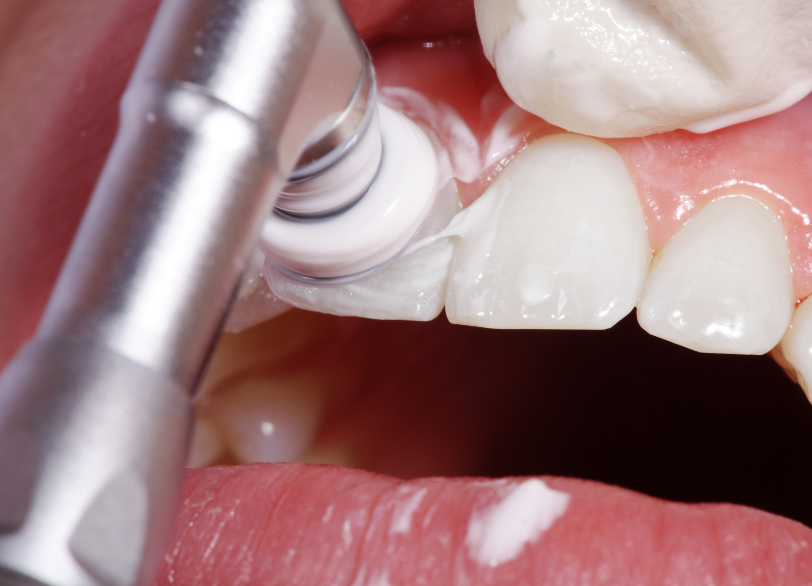 PMTCによって得られる効果｜板橋グレース歯科医院